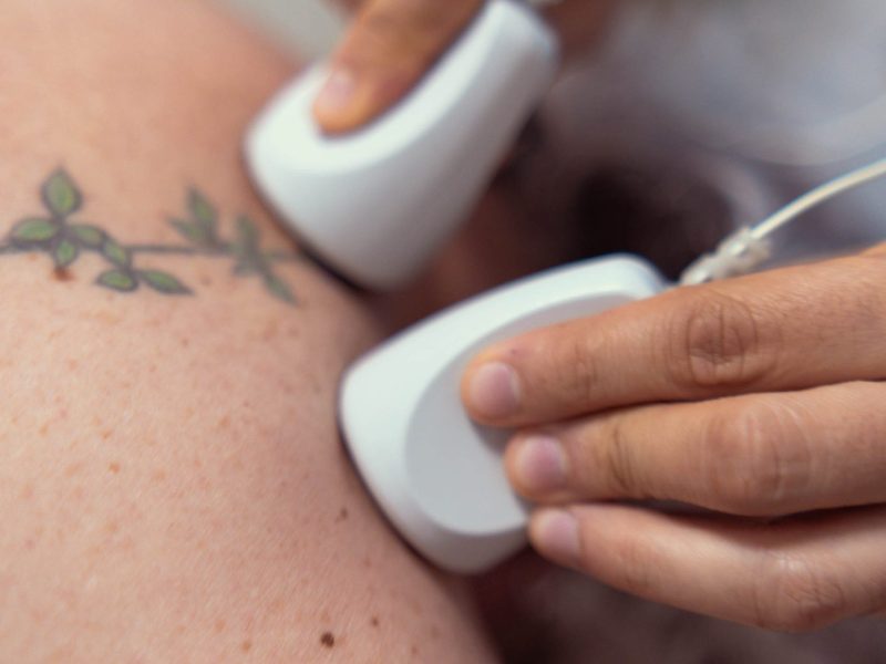 aplicacion de ondas de choche focales